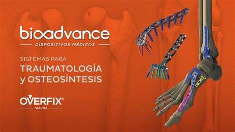 Sistemas OVERFIX para Traumatología y Osteosíntesis .